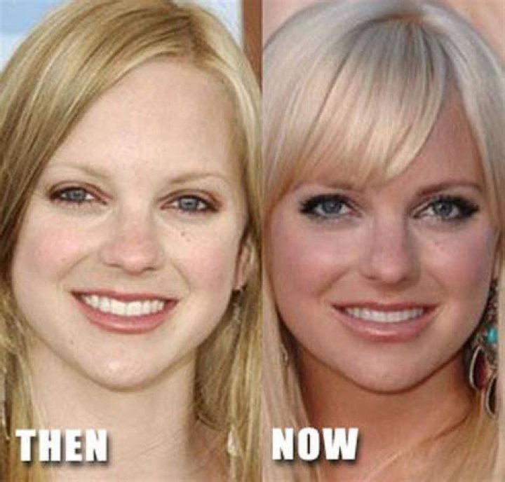 Anna Faris Plastic Surgery Before and After
