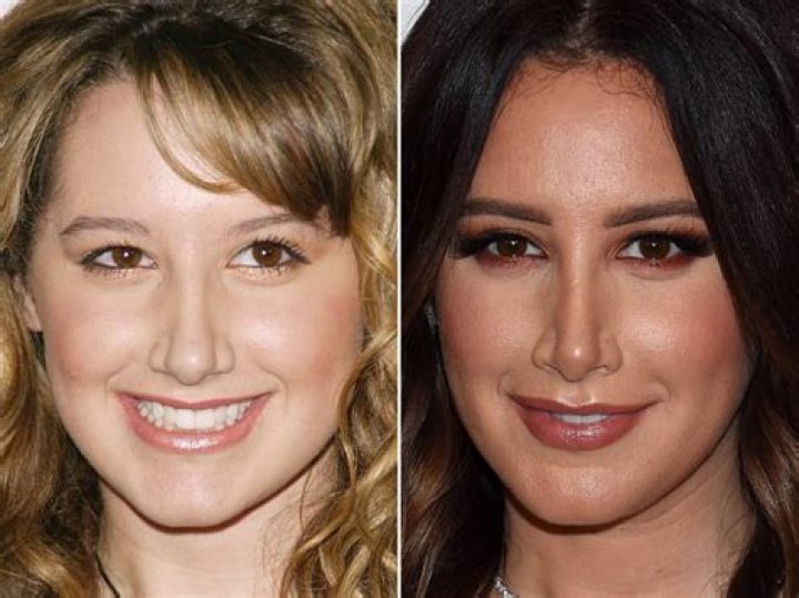 Ashley Tisdale Plastic Surgery Before and After