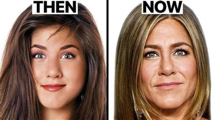 Jennifer Aniston Plastic Surgery