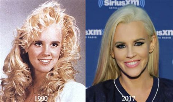 Jenny McCarthy Plastic Surgery