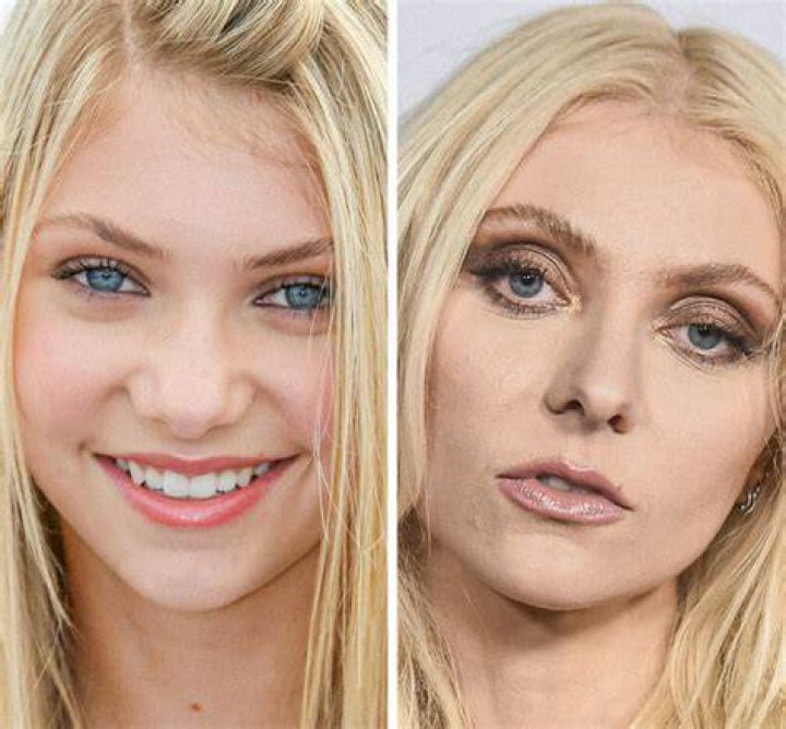 Taylor Momsen Breast Implants Plastic Surgery Before and After